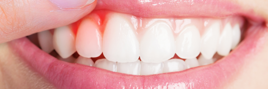 又上火又怕冷？上熱下寒、水火不濟，教你調回來！