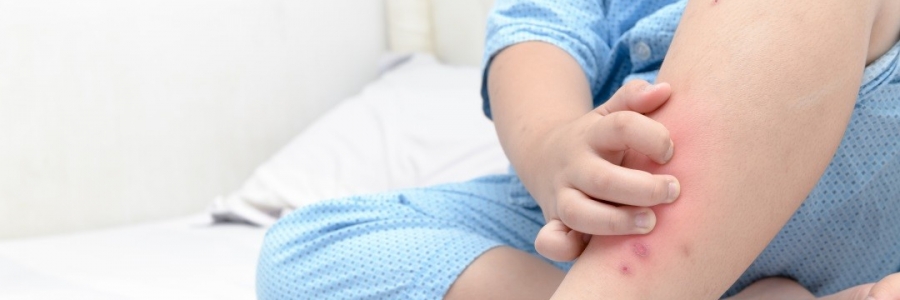 學古人這樣驅蚊，從此不再“蚊”風喪膽！