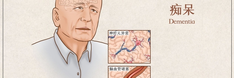 “馬什么梅？”年紀(jì)輕輕老忘事，竟是癡呆的前兆？！