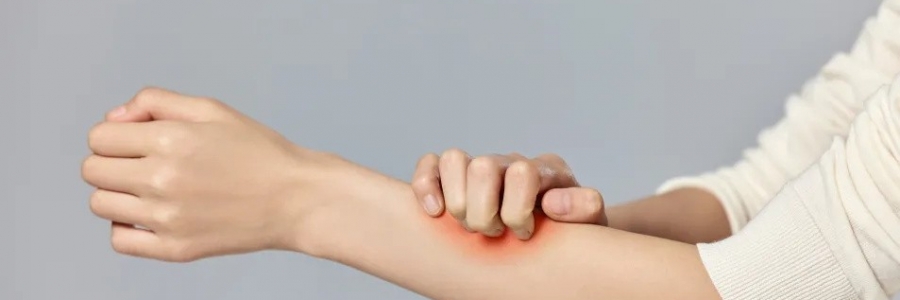 濕疹、瘙癢、蕁麻疹……患皮膚病，也許是好事！